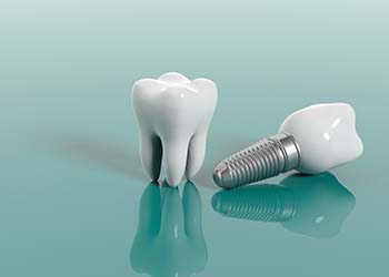 model of a real tooth next to a dental implant