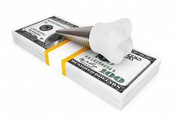 dental implant lying on top of a stack of hundred-dollar bills